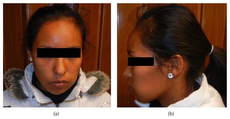 https://cdn.ncbi.nlm.nih.gov/pmc/blobs/36fd/4377457/680df6caa776/CRIPA2015-245026.001.jpg