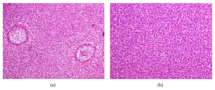 https://cdn.ncbi.nlm.nih.gov/pmc/blobs/36fd/4377457/e4bc01500672/CRIPA2015-245026.002.jpg