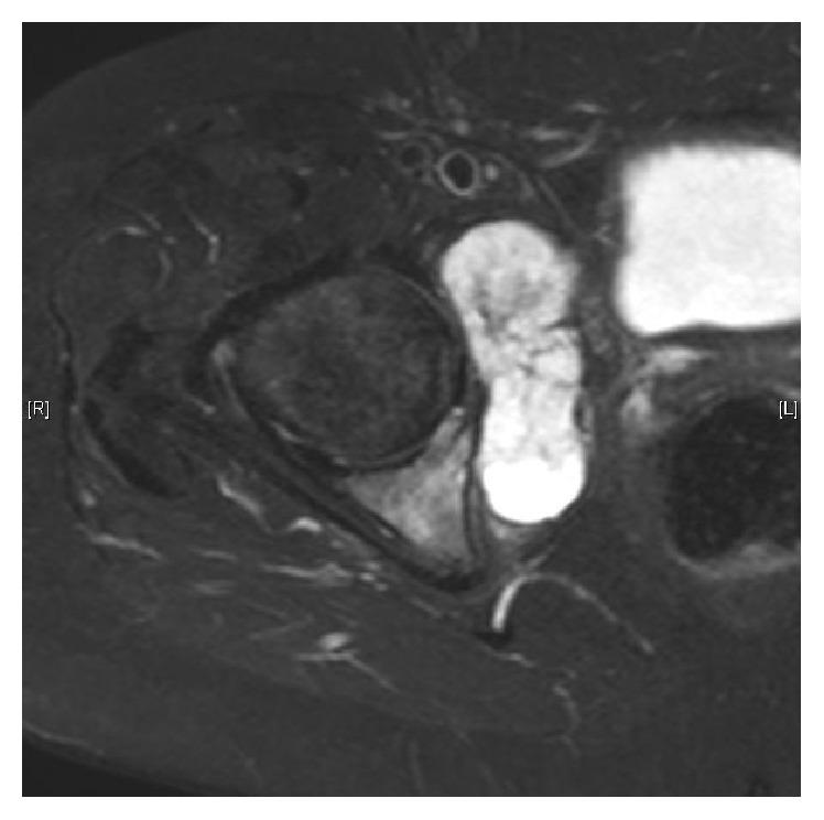 https://cdn.ncbi.nlm.nih.gov/pmc/blobs/3702/4854988/7405016a6fca/SARCOMA2016-2549616.001.jpg
