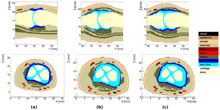 https://cdn.ncbi.nlm.nih.gov/pmc/blobs/370b/9611080/df08eeb74e7e/tomography-08-00196-g004.jpg