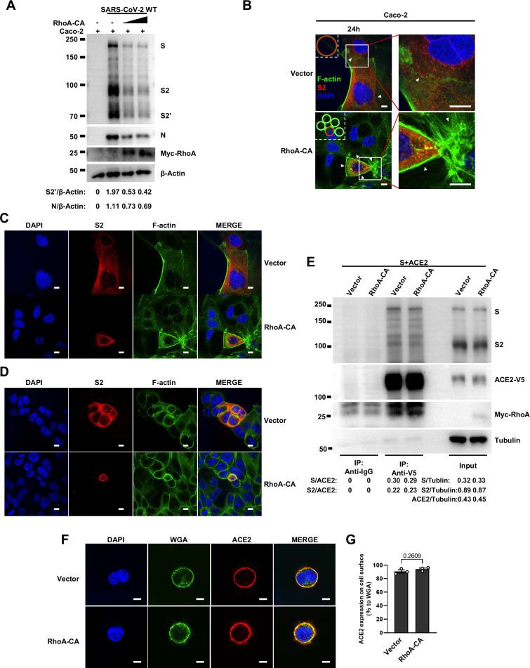 https://cdn.ncbi.nlm.nih.gov/pmc/blobs/370f/11820142/06c2d300b5c3/elife-98593-fig5-figsupp2.jpg