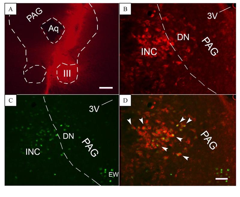 https://cdn.ncbi.nlm.nih.gov/pmc/blobs/3714/5460614/e946d5654d25/jbr-31-03-256-fig3.jpg