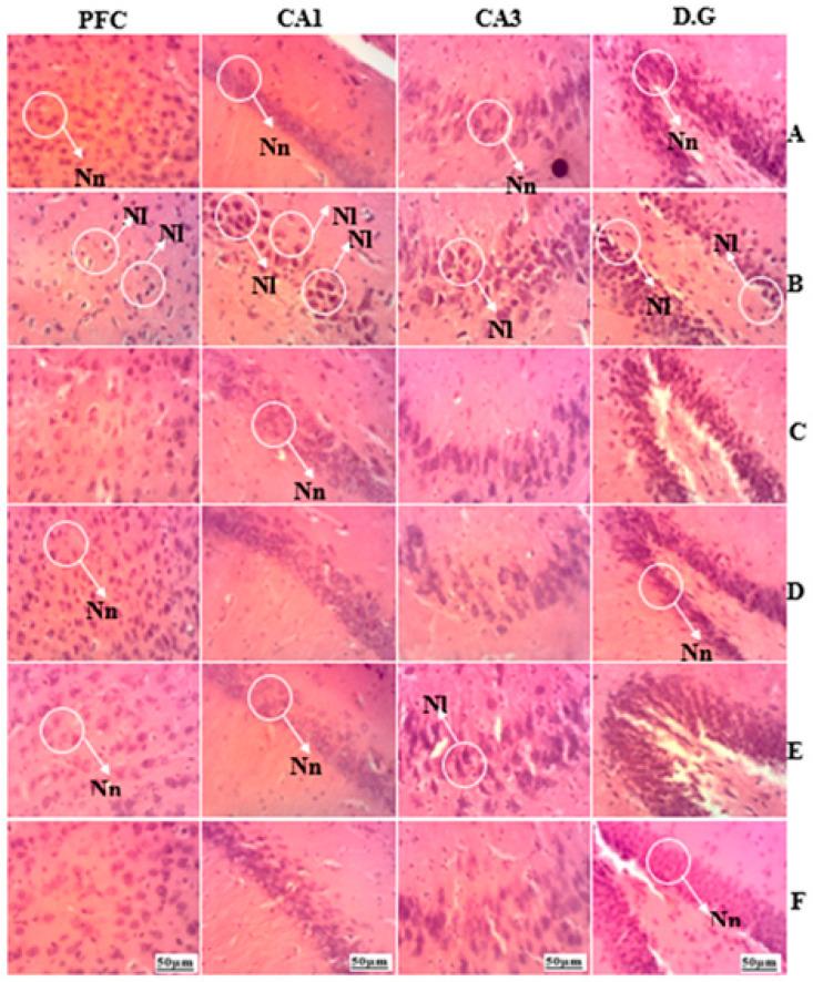 https://cdn.ncbi.nlm.nih.gov/pmc/blobs/3715/10670073/fa7d2aed717e/brainsci-13-01561-g015.jpg