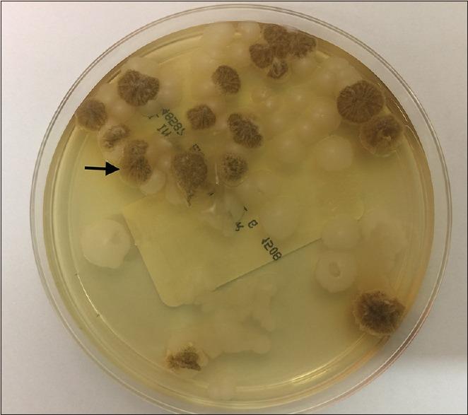 https://cdn.ncbi.nlm.nih.gov/pmc/blobs/3715/5840961/f15bb1ec6b8a/CJ-15-5-g004.jpg