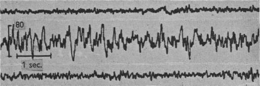 https://cdn.ncbi.nlm.nih.gov/pmc/blobs/371d/1393000/1db03f1ec689/jphysiol01460-0195-a.jpg