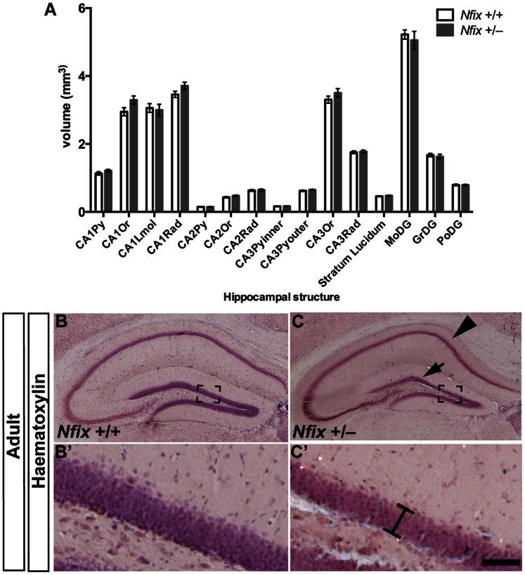 https://cdn.ncbi.nlm.nih.gov/pmc/blobs/371e/3679126/cf07660298ad/pone.0065478.g006.jpg