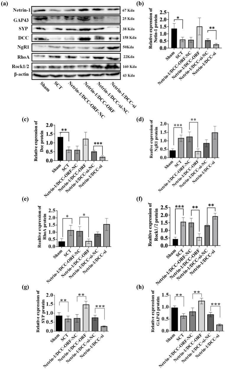 https://cdn.ncbi.nlm.nih.gov/pmc/blobs/371f/11909580/351b39fbf5c5/j_tnsci-2025-0365-fig023.jpg