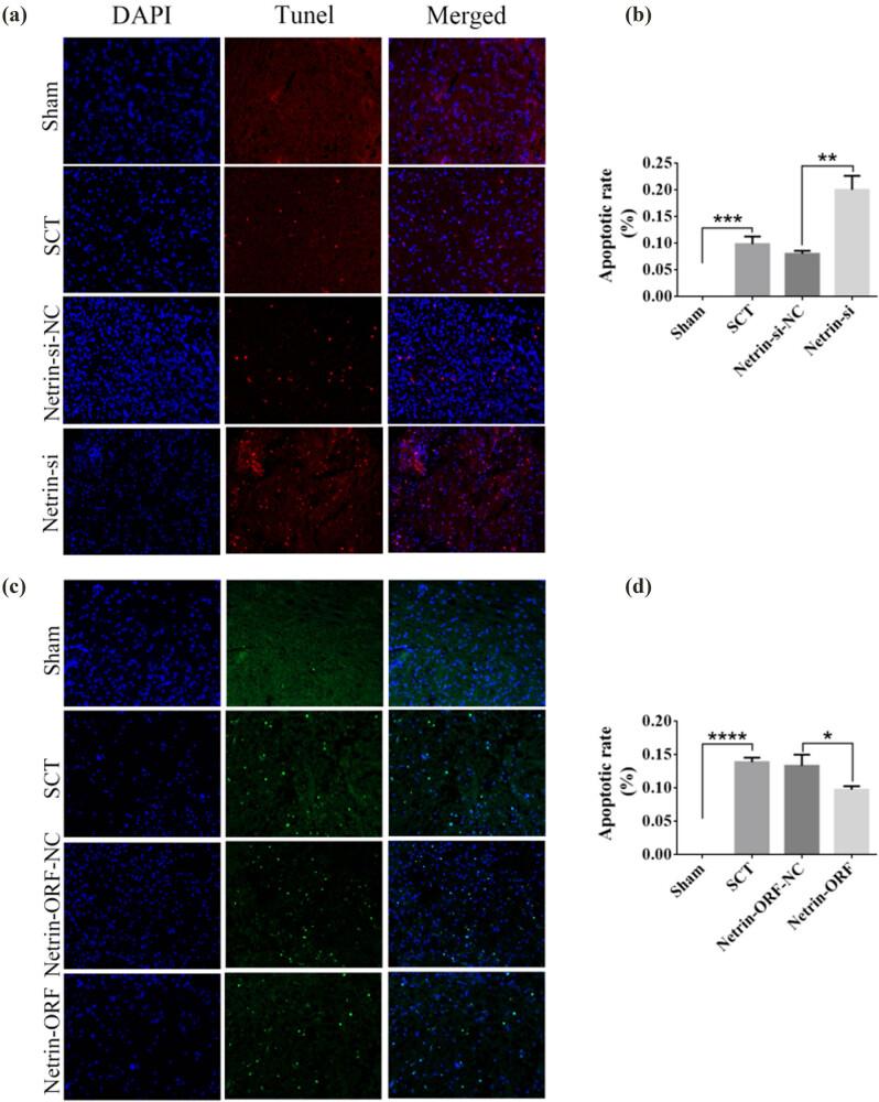https://cdn.ncbi.nlm.nih.gov/pmc/blobs/371f/11909580/63c06d6aaba8/j_tnsci-2025-0365-fig008.jpg