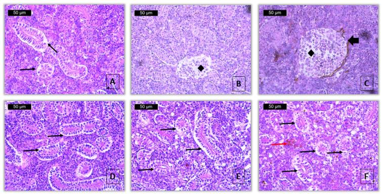 https://cdn.ncbi.nlm.nih.gov/pmc/blobs/3722/12299302/7197cebe13e5/toxics-13-00518-g004.jpg