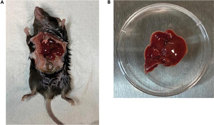 https://cdn.ncbi.nlm.nih.gov/pmc/blobs/3729/8102171/0abd9b253dbd/gr2.jpg