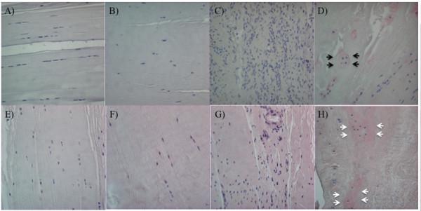 https://cdn.ncbi.nlm.nih.gov/pmc/blobs/372f/3672799/cdaf1fabcb4e/ar4165-6.jpg