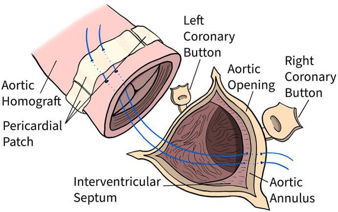 https://cdn.ncbi.nlm.nih.gov/pmc/blobs/3730/10750473/c94d68be18dd/fx1.jpg