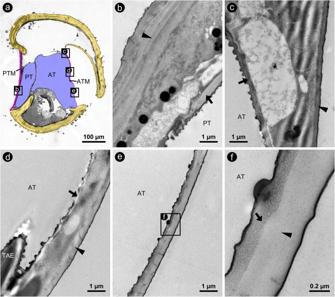 https://cdn.ncbi.nlm.nih.gov/pmc/blobs/3731/5681576/5a38c323ffbb/41598_2017_15282_Fig4_HTML.jpg