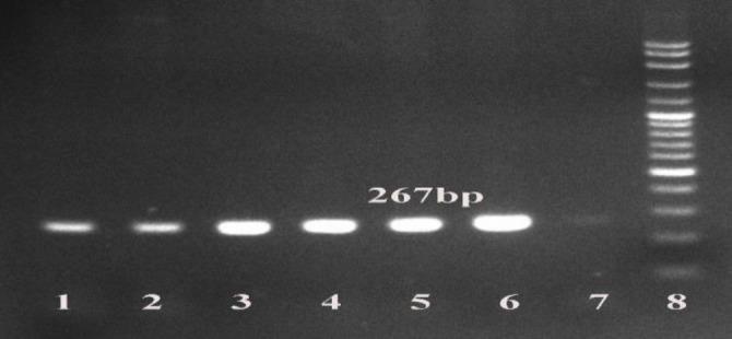 https://cdn.ncbi.nlm.nih.gov/pmc/blobs/3738/12295529/211eab0449d3/vrf-16-317-g005.jpg