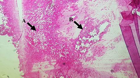 https://cdn.ncbi.nlm.nih.gov/pmc/blobs/3754/7593109/9f7a34308206/rjaa419f2.jpg