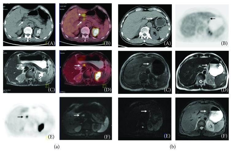 https://cdn.ncbi.nlm.nih.gov/pmc/blobs/3759/6378050/163cf3117b37/GRP2019-9564627.004.jpg