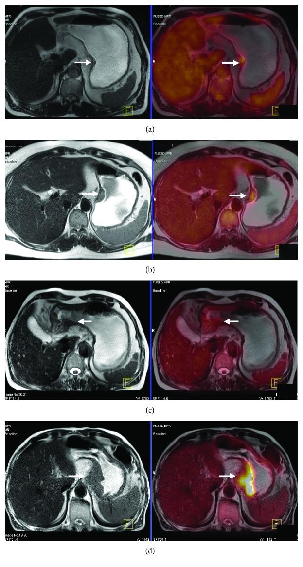 https://cdn.ncbi.nlm.nih.gov/pmc/blobs/3759/6378050/f57c9ecbfad0/GRP2019-9564627.003.jpg
