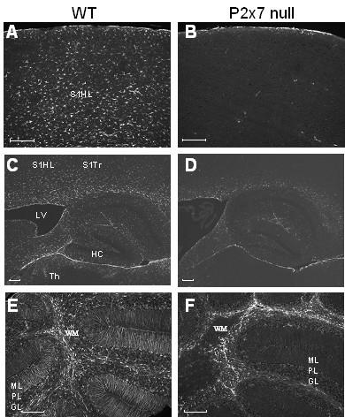 https://cdn.ncbi.nlm.nih.gov/pmc/blobs/375c/2518548/b37dcdca10dd/1742-2094-5-33-5.jpg