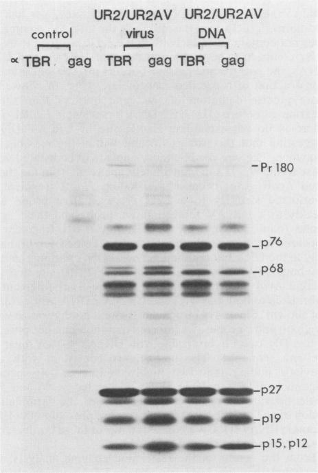 https://cdn.ncbi.nlm.nih.gov/pmc/blobs/3760/255753/a18650ecb490/jvirol00135-0255-a.jpg