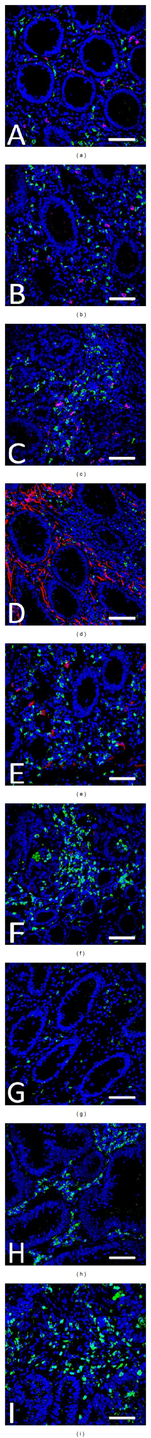 https://cdn.ncbi.nlm.nih.gov/pmc/blobs/3765/3848341/2ea60043dcb0/TSWJ2013-630869.002.jpg