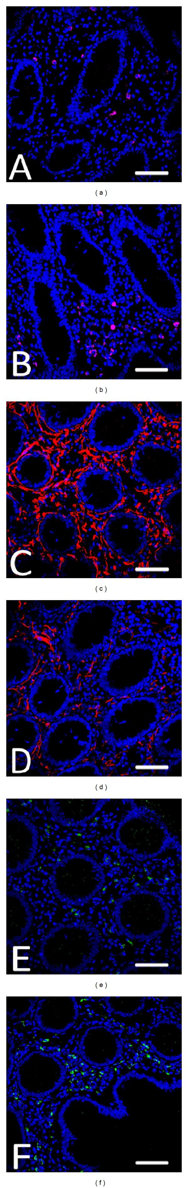https://cdn.ncbi.nlm.nih.gov/pmc/blobs/3765/3848341/ad4b0bf693d9/TSWJ2013-630869.004.jpg