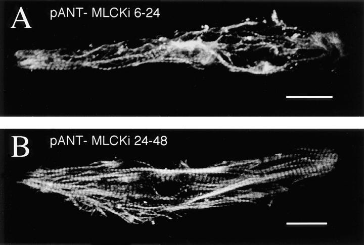 https://cdn.ncbi.nlm.nih.gov/pmc/blobs/3766/2132793/88b7f9d03e35/JCB9802048.f5ab.jpg