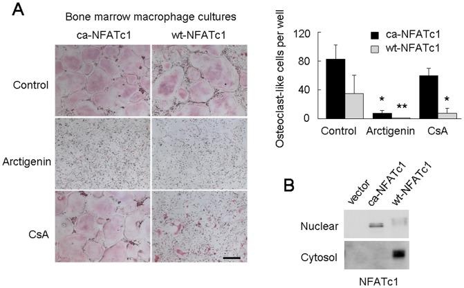 https://cdn.ncbi.nlm.nih.gov/pmc/blobs/3768/3895012/bd34c5bbd784/pone.0085878.g004.jpg
