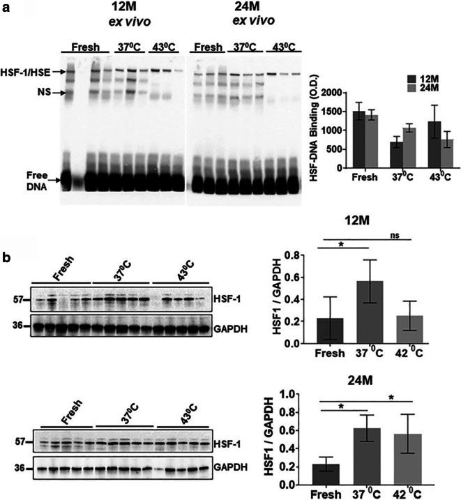 https://cdn.ncbi.nlm.nih.gov/pmc/blobs/3768/8492860/c8820b86dc44/11357_2021_362_Fig3_HTML.jpg