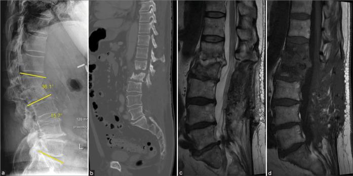 https://cdn.ncbi.nlm.nih.gov/pmc/blobs/3772/9282791/19a40d881186/SNI-13-256-g002.jpg