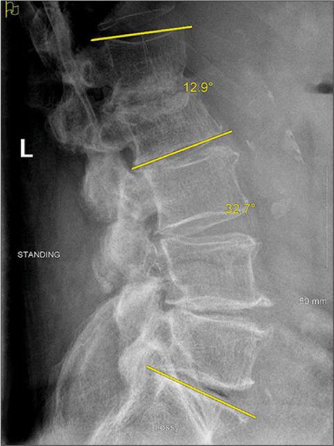 https://cdn.ncbi.nlm.nih.gov/pmc/blobs/3772/9282791/a667fa2bf02f/SNI-13-256-g004.jpg