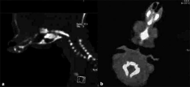 https://cdn.ncbi.nlm.nih.gov/pmc/blobs/3785/3173934/7133f54c59ce/JPN-6-94-g004.jpg