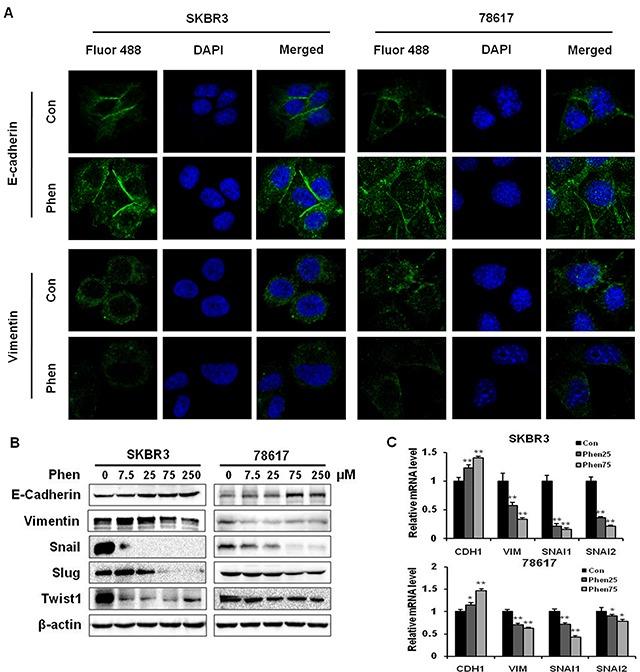 https://cdn.ncbi.nlm.nih.gov/pmc/blobs/3789/5601143/6479d12c9f3d/oncotarget-08-60342-g004.jpg