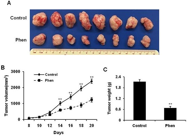 https://cdn.ncbi.nlm.nih.gov/pmc/blobs/3789/5601143/b89c2af7c63a/oncotarget-08-60342-g002.jpg