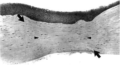 https://cdn.ncbi.nlm.nih.gov/pmc/blobs/378b/1312114/9f8d8944853f/taos00005-0781-a.jpg