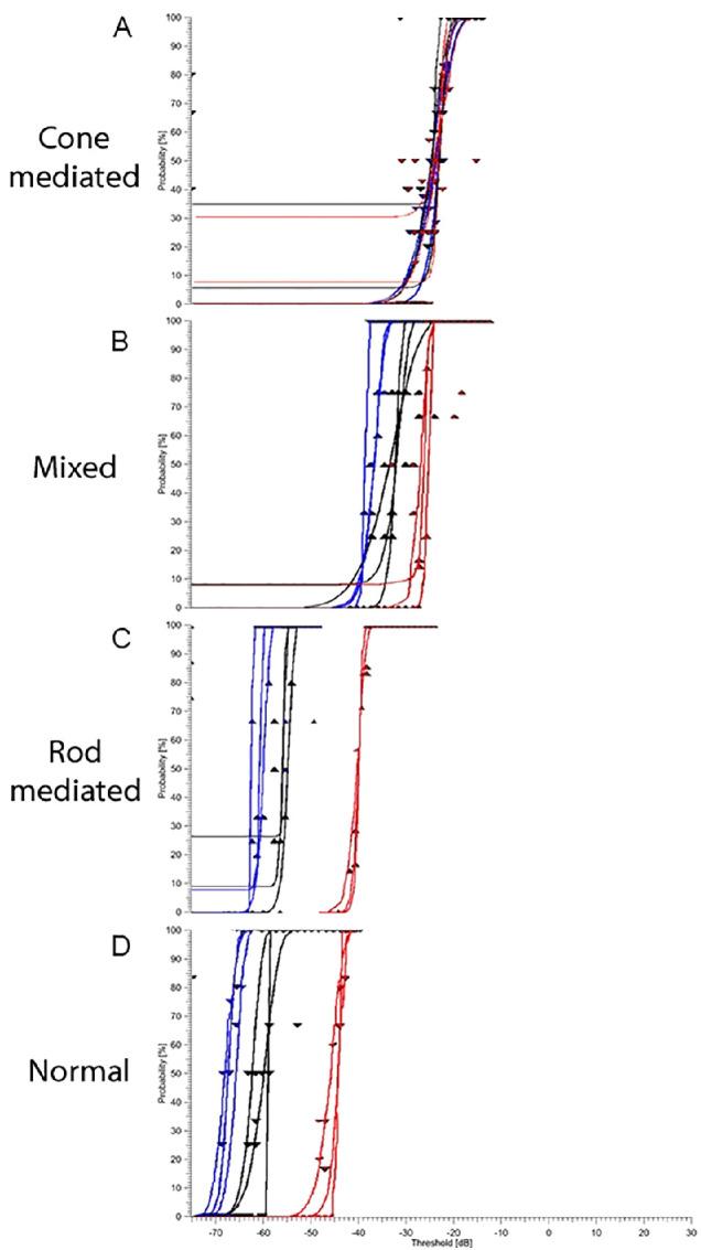 https://cdn.ncbi.nlm.nih.gov/pmc/blobs/378b/7552938/2096a6792c69/tvst-9-11-9-f002.jpg