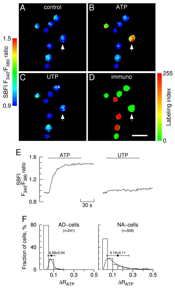 https://cdn.ncbi.nlm.nih.gov/pmc/blobs/378f/1906789/e1a414186e22/1471-2202-8-39-6.jpg