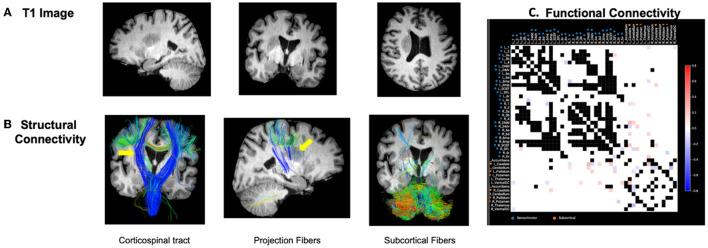 https://cdn.ncbi.nlm.nih.gov/pmc/blobs/3790/10359072/cd6e76727920/fneur-14-1063408-g0002.jpg