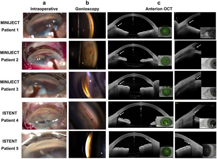 https://cdn.ncbi.nlm.nih.gov/pmc/blobs/3791/11868348/e04e0b97771d/417_2024_6642_Fig4_HTML.jpg