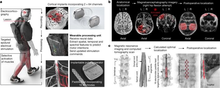 https://cdn.ncbi.nlm.nih.gov/pmc/blobs/3792/10232367/c5e6d991ec47/41586_2023_6094_Fig1_HTML.jpg