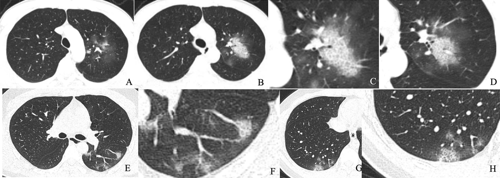 https://cdn.ncbi.nlm.nih.gov/pmc/blobs/3795/7887832/2f648fd4273c/12880_2021_564_Fig3_HTML.jpg