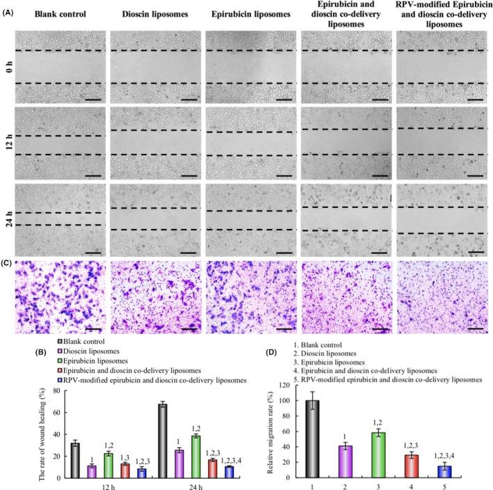 https://cdn.ncbi.nlm.nih.gov/pmc/blobs/379a/7004549/2f0b8710af1b/CAS-111-621-g006.jpg