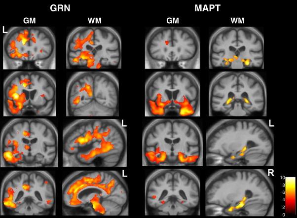 https://cdn.ncbi.nlm.nih.gov/pmc/blobs/37a2/2941039/cc3c18ddeca6/gr3.jpg