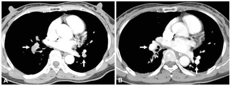 https://cdn.ncbi.nlm.nih.gov/pmc/blobs/37a3/3539053/4544986fd837/kcj-42-853-g003.jpg