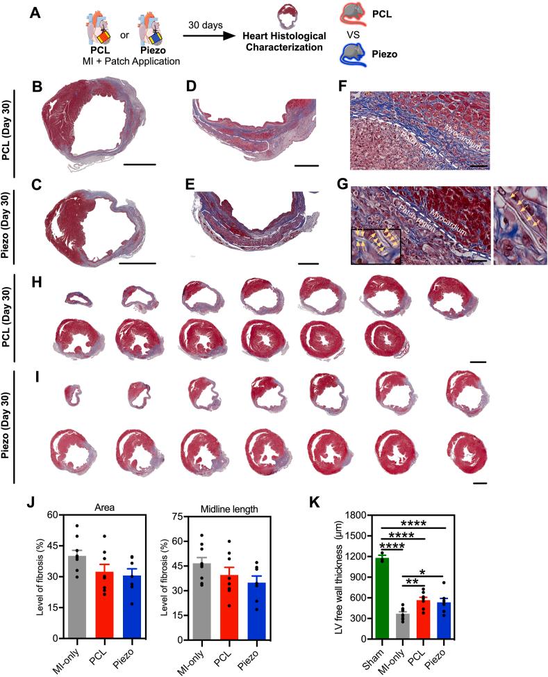 https://cdn.ncbi.nlm.nih.gov/pmc/blobs/37a4/12033997/1e08c6612ece/gr4.jpg