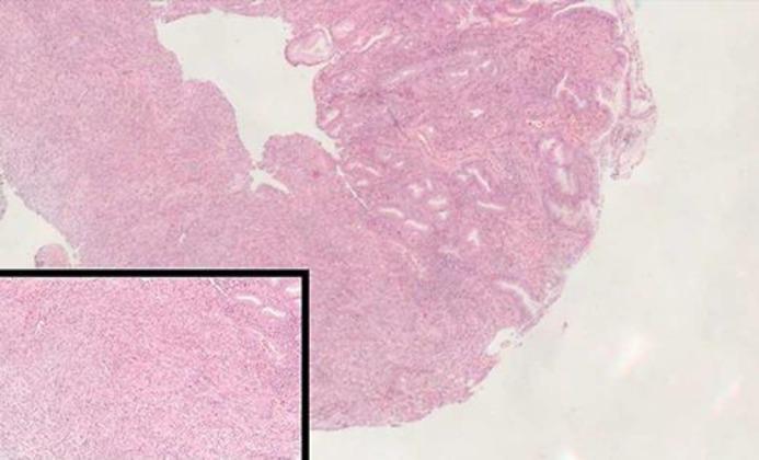 https://cdn.ncbi.nlm.nih.gov/pmc/blobs/37a5/6244015/2cdf97089b75/cro-0011-0638-g04.jpg