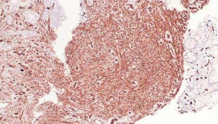 https://cdn.ncbi.nlm.nih.gov/pmc/blobs/37a5/6244015/68088aeba594/cro-0011-0638-g09.jpg