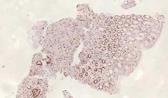 https://cdn.ncbi.nlm.nih.gov/pmc/blobs/37a5/6244015/6a1c26e39417/cro-0011-0638-g10.jpg