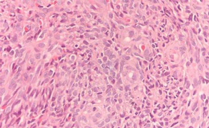 https://cdn.ncbi.nlm.nih.gov/pmc/blobs/37a5/6244015/b17071f9644a/cro-0011-0638-g05.jpg