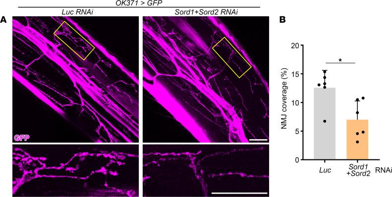 https://cdn.ncbi.nlm.nih.gov/pmc/blobs/37a7/10322690/e4e5724e7b44/jciinsight-8-164954-g198.jpg