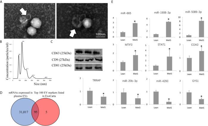https://cdn.ncbi.nlm.nih.gov/pmc/blobs/37a9/8387871/d747a76b46f3/fendo-12-687586-g001.jpg
